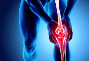 Der Bewegungsapparat Schmerzen in Knie